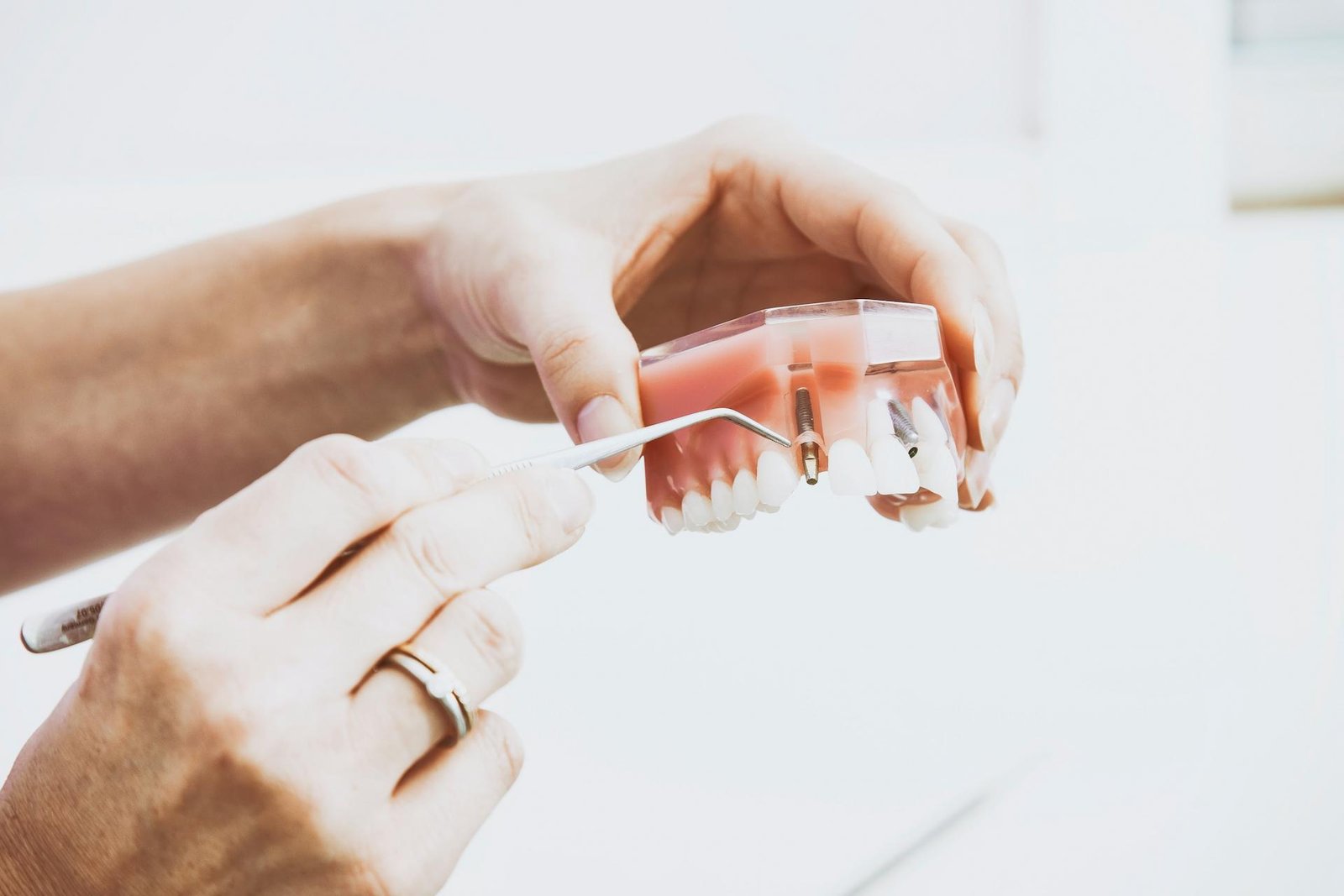 tooth replacement